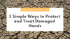 3 Simple Ways to Protect and Treat Damaged Hands